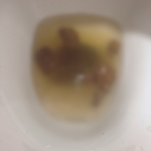 うんち浮いてるものと浮いてないものがあった（笑）