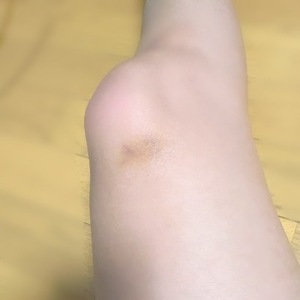 膝蹴りした結果