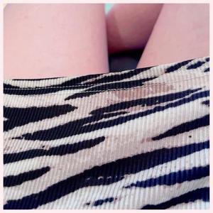 コンプレックス割