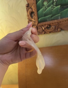 敗北