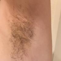 腋毛の成長