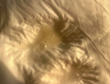 太陽の光に当たった朝1の痰🩷🩷🩷笑笑