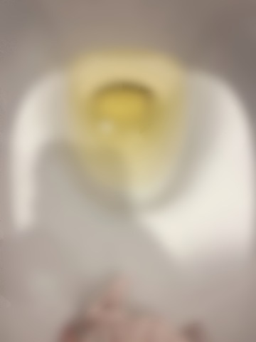 朝黄色いおしっこ出てきた???