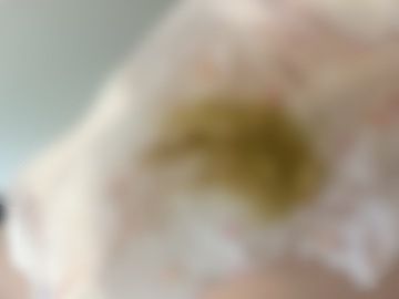 うんこべちゃっと付いた( ̄∇ ̄)!!