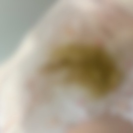 うんこべちゃっと付いた(￣∇￣)！！