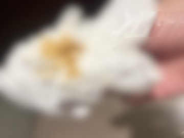うんこ付きトイレットペーパーと手にも付いた!笑笑