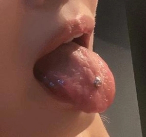 チュパっ