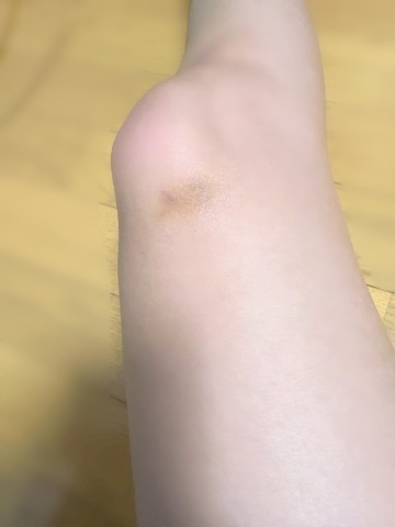 膝蹴りした結果