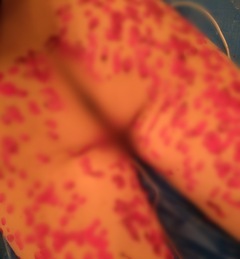 白と赤のコントラスト…