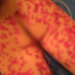 白と赤のコントラスト…