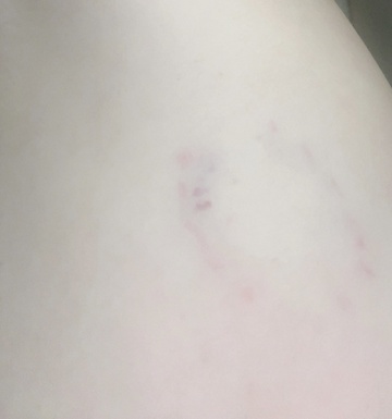 許されない抵抗‥