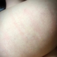 打たれてみたら痛気持ちよくて🤭